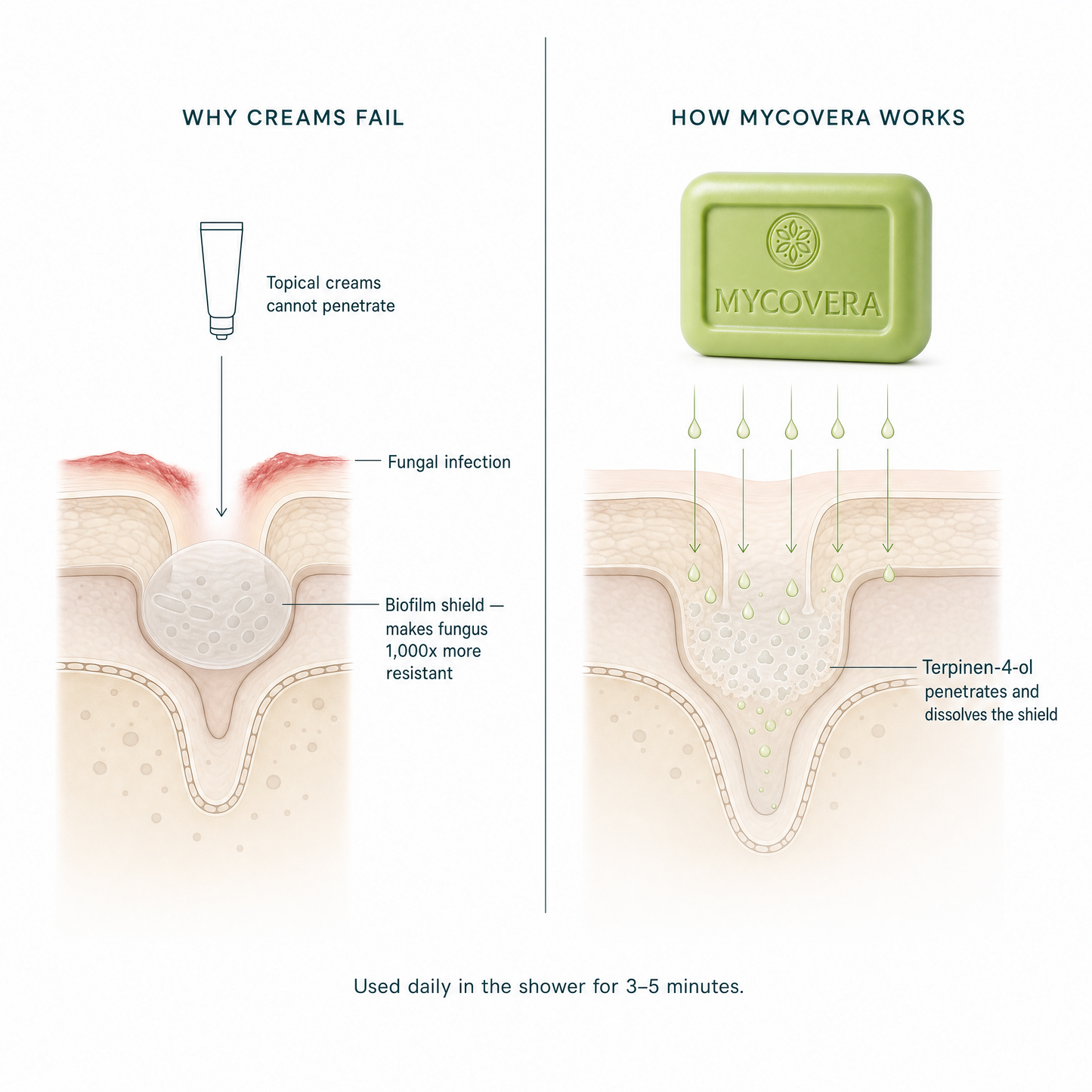 Mycovera BioShield Soap