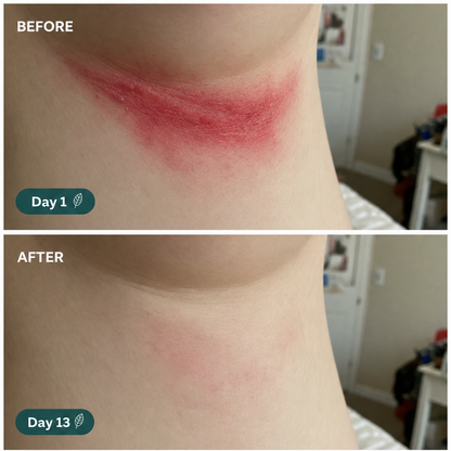 Mycovera BioShield Soap